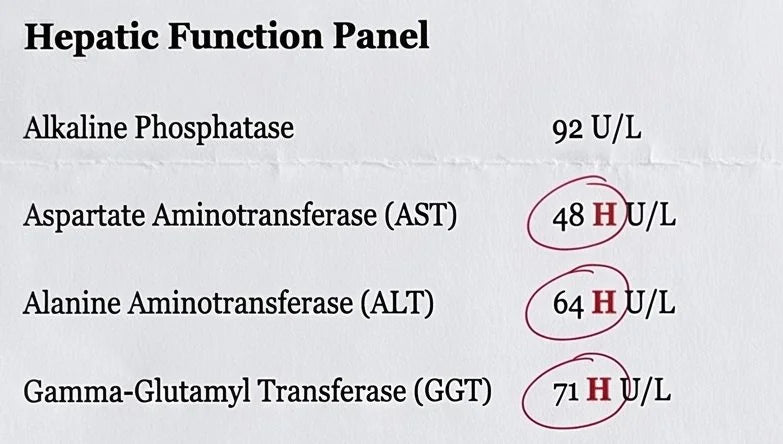 Gary's June liver panel: AST 48, ALT 64 and GGT 71, circled high