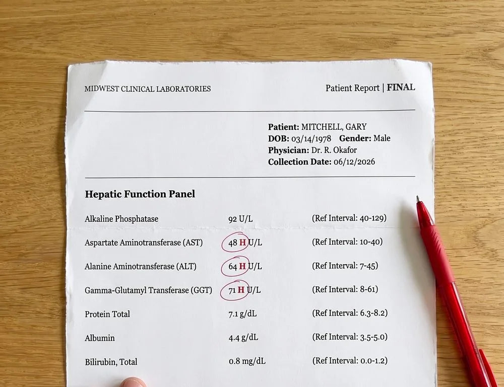 Gary's June 12 liver panel: AST 48, ALT 64 and GGT 71 circled high